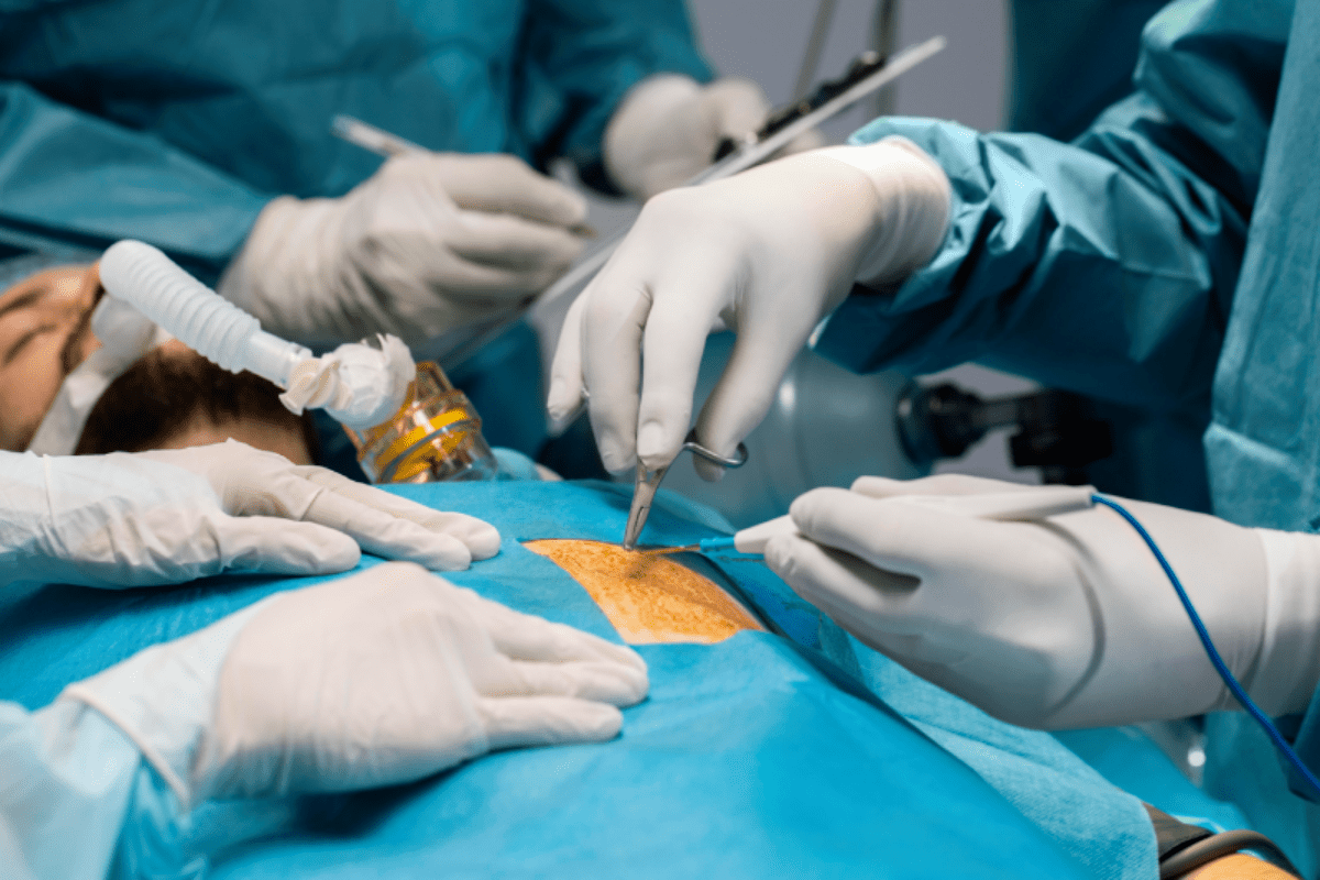 Hernia-Surgery-service