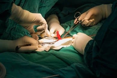 Laparoscopic-Appendectomy