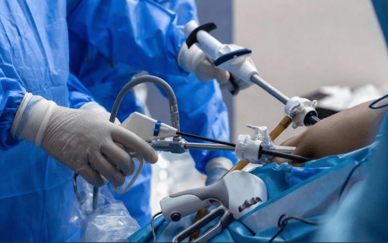 Laparoscopic-Surgery