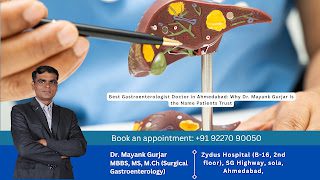 Best Gastroenterologist Doctor in Ahmedabad: Why Dr. Mayank Gurjar Is the Name Patients Trust